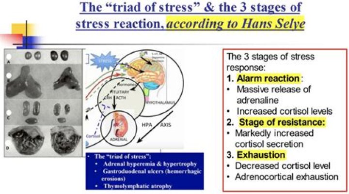 Why is Hans Selye referred to as the father of stress